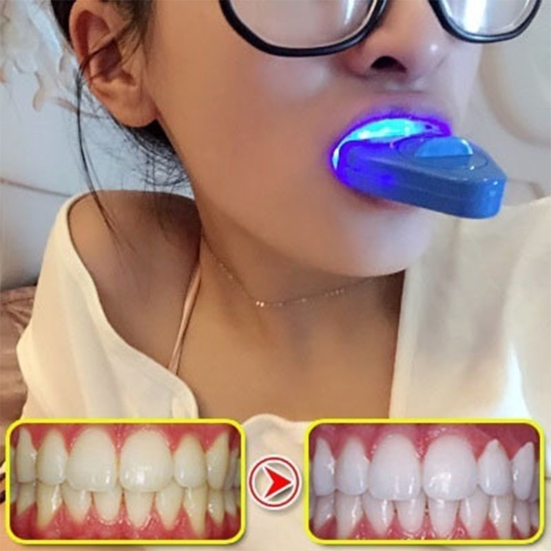 LED-Zahnaufhellungslicht Blaue – Teeth Whitening Uv Light Bewertung und Preis
